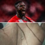 Inaki Williams played for two years with a glass in his foot – Athletic Club Coach